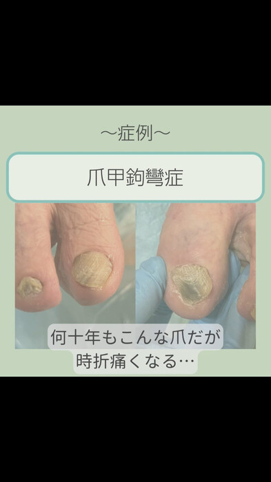 画像328